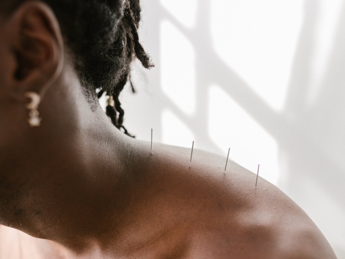 What Is Traditional Chinese Medicine?