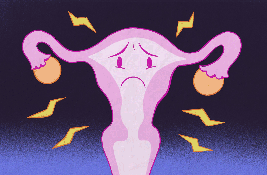 Can Stress Delay Your Menstrual Cycle?